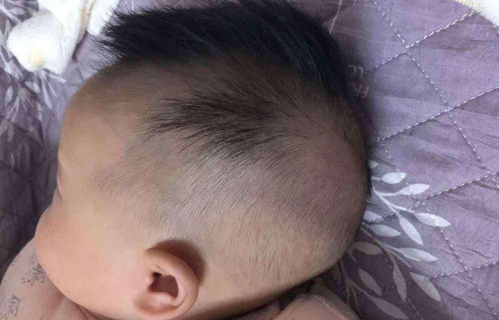 女兒3歲了頭發(fā)稀少又軟 寶寶3歲頭發(fā)為啥比別的孩子長得慢？家長要留心，這些原因很關(guān)鍵