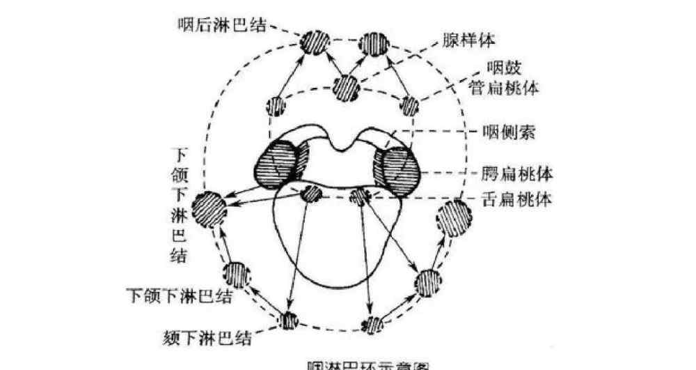 扁桃體化膿高燒不退怎么辦 家長們注意了，扁桃體反復(fù)發(fā)炎、高燒不退，原因很有可能是這個(gè)