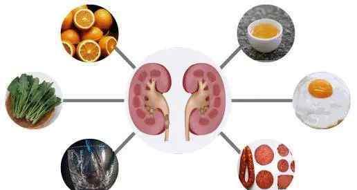 腎結石自然療法 在家中對抗腎臟結石的8種自然療法！|中老年人健康之路（493）