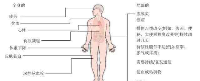 腸癌早期癥狀 早期腸癌癥狀不明顯，一旦出現(xiàn)3種信號就要警惕，早發(fā)現(xiàn)早安全