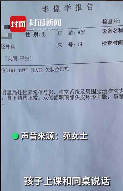 小學生被老師揪頭發(fā)罰站致皮骨分離 家長：10多天后老師才被停課