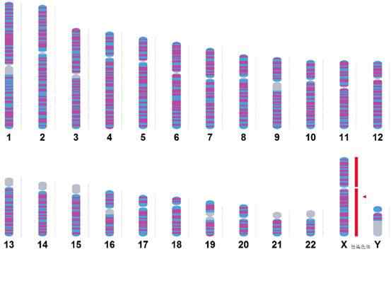 女人染色體異常的癥狀 性染色體異常：你看到的也許只是表面