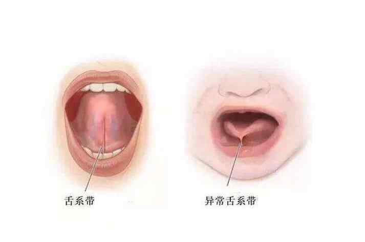 二歲半不會說話 2歲寶寶不會說話，原來都是“它”惹的禍