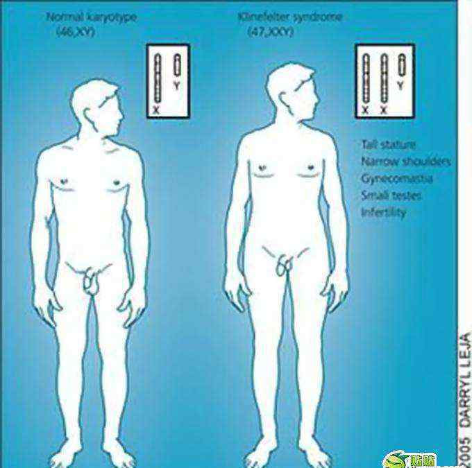 雙性人下體什么樣 男子發(fā)現(xiàn)自己來月經(jīng)是女兒身，雙性人下體到底是什么樣？男子發(fā)現(xiàn)自己來月經(jīng)是女兒身，雙性人下體到底是什么樣？