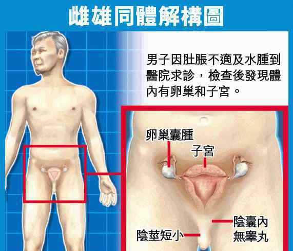 雙性人下體什么樣 男子發(fā)現(xiàn)自己來月經(jīng)是女兒身，雙性人下體到底是什么樣？男子發(fā)現(xiàn)自己來月經(jīng)是女兒身，雙性人下體到底是什么樣？