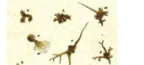 巨型阿米巴蟲 生存在海底1萬米下的生物 巨型阿米巴蟲圖片