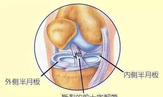 鍛煉膝蓋最好的方法 15個膝關(guān)節(jié)實用康復(fù)鍛煉方法