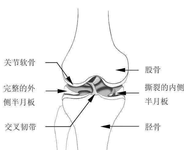 鍛煉膝蓋最好的方法 15個膝關(guān)節(jié)實用康復(fù)鍛煉方法