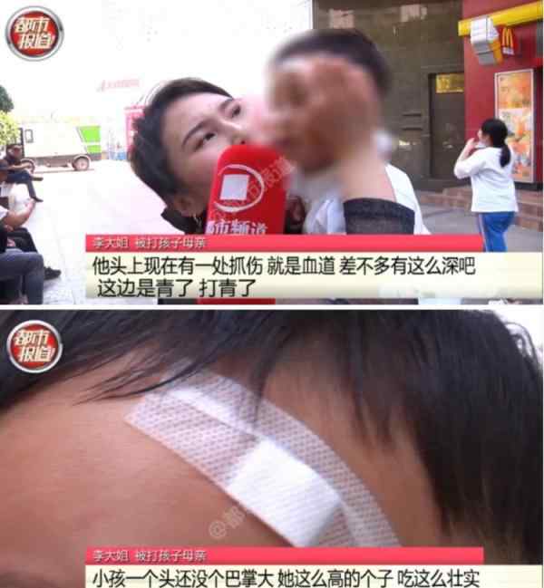 一歲幼兒遭女子“鐵砂掌”扇頭！母親也被其抓撓 原因引網友吐槽