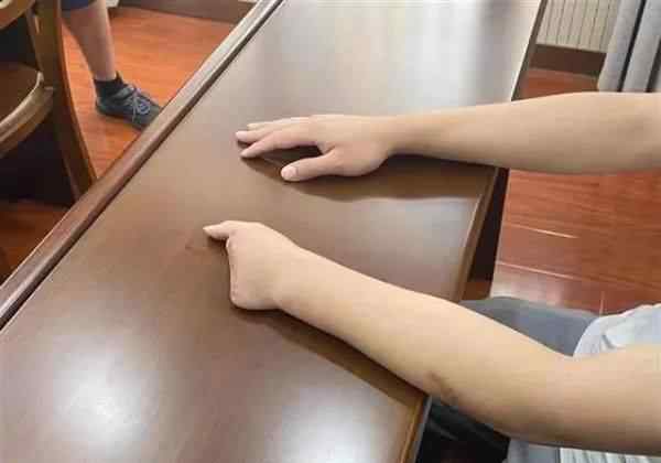 21歲小伙被剁斷4根手指 這意味著什么?